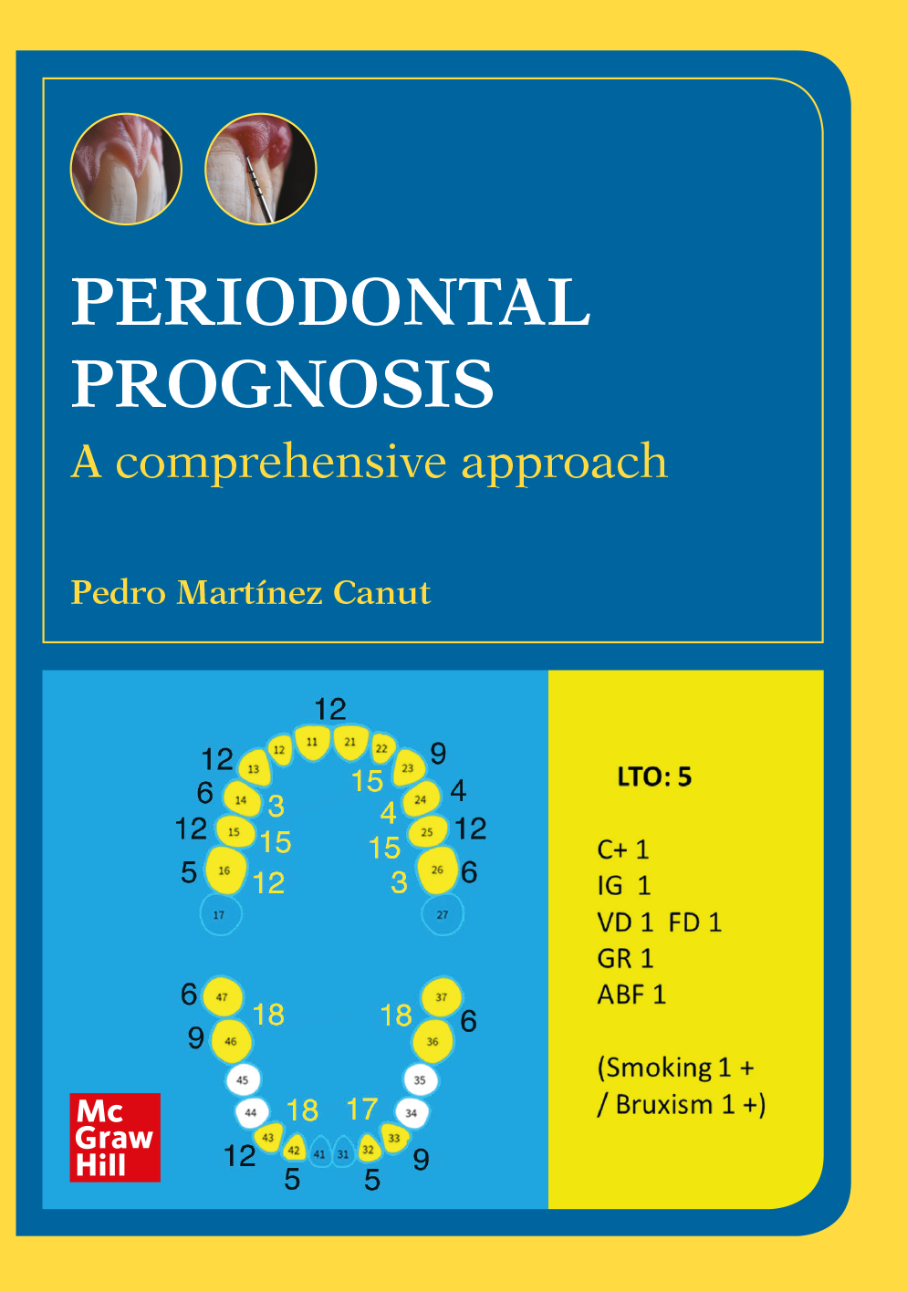 Periodontal prognosis. A comprehensive approach